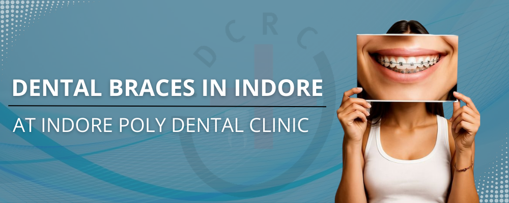 Dental Braces in Indore at Indore Poly Dental Clinic