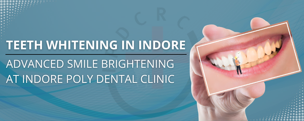 Teeth Whitening in Indore – Advanced Smile Brightening at Indore Poly Dental Clinic