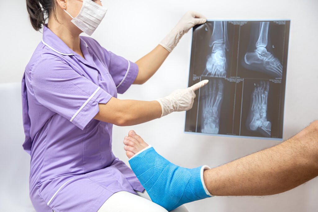 Doctor examining X-ray before bone grafting treatment for foot injury