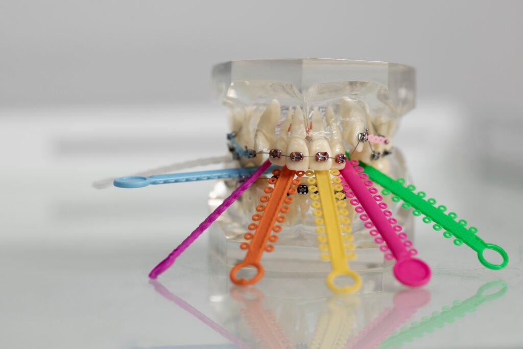 Orthodontic braces with colorful elastic bands used for teeth alignment