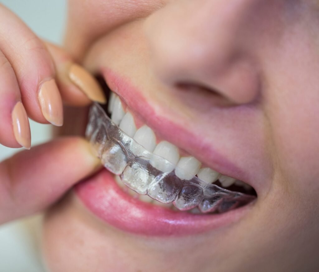 Patient wearing clear aligners for invisible braces treatment at Indore Poly Dental Clinic