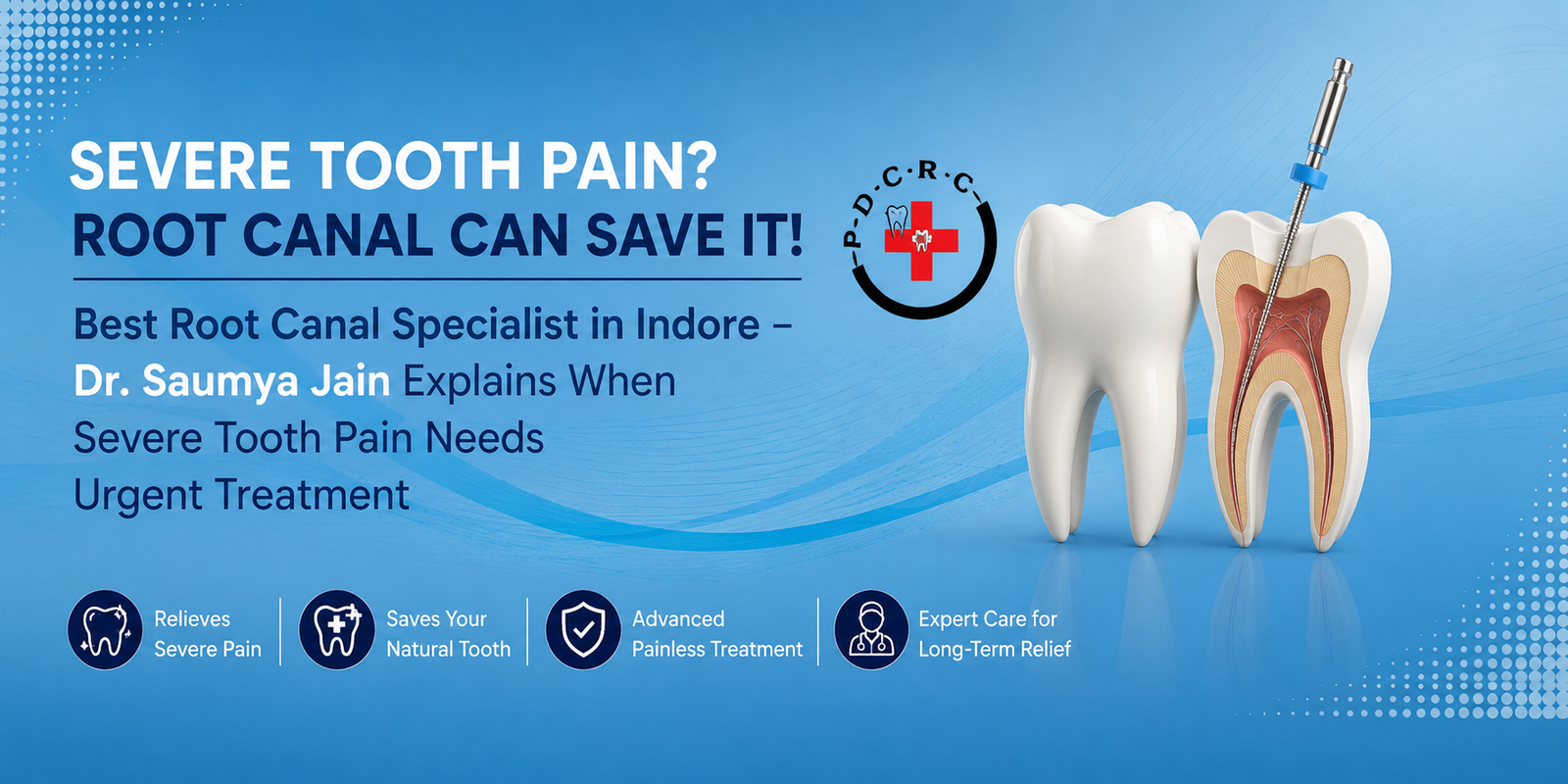 Best Root Canal Specialist in Indore – Dr. Saumya Jain Explains When Severe Tooth Pain Needs Urgent Treatment